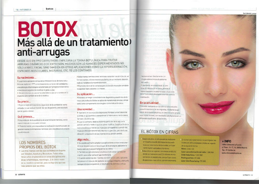 botox-mas-alla-de-un-tratamiento-antiarrugas-te-interesa
